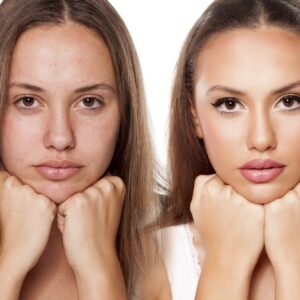 תיקון/שינוי תמונה